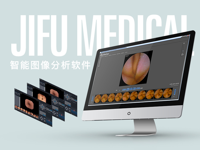 智能图像分析